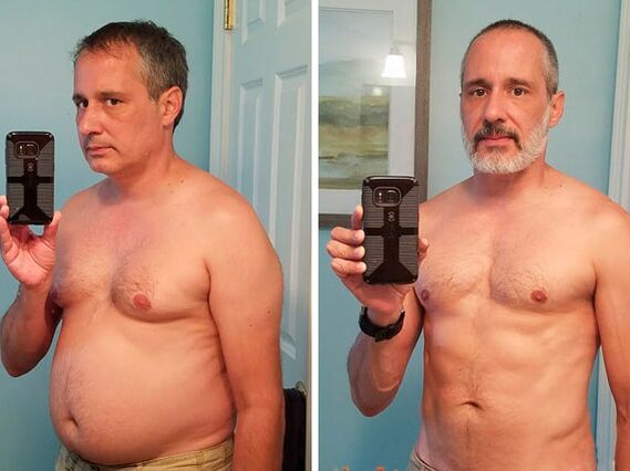 Antes y después del tratamiento con gotas Alcozar
